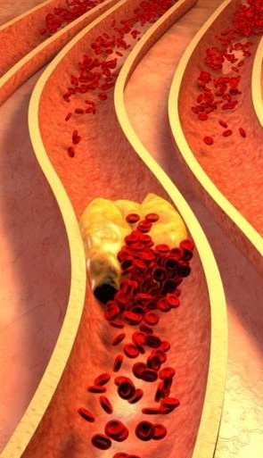 Effect Leptozan on metabolism